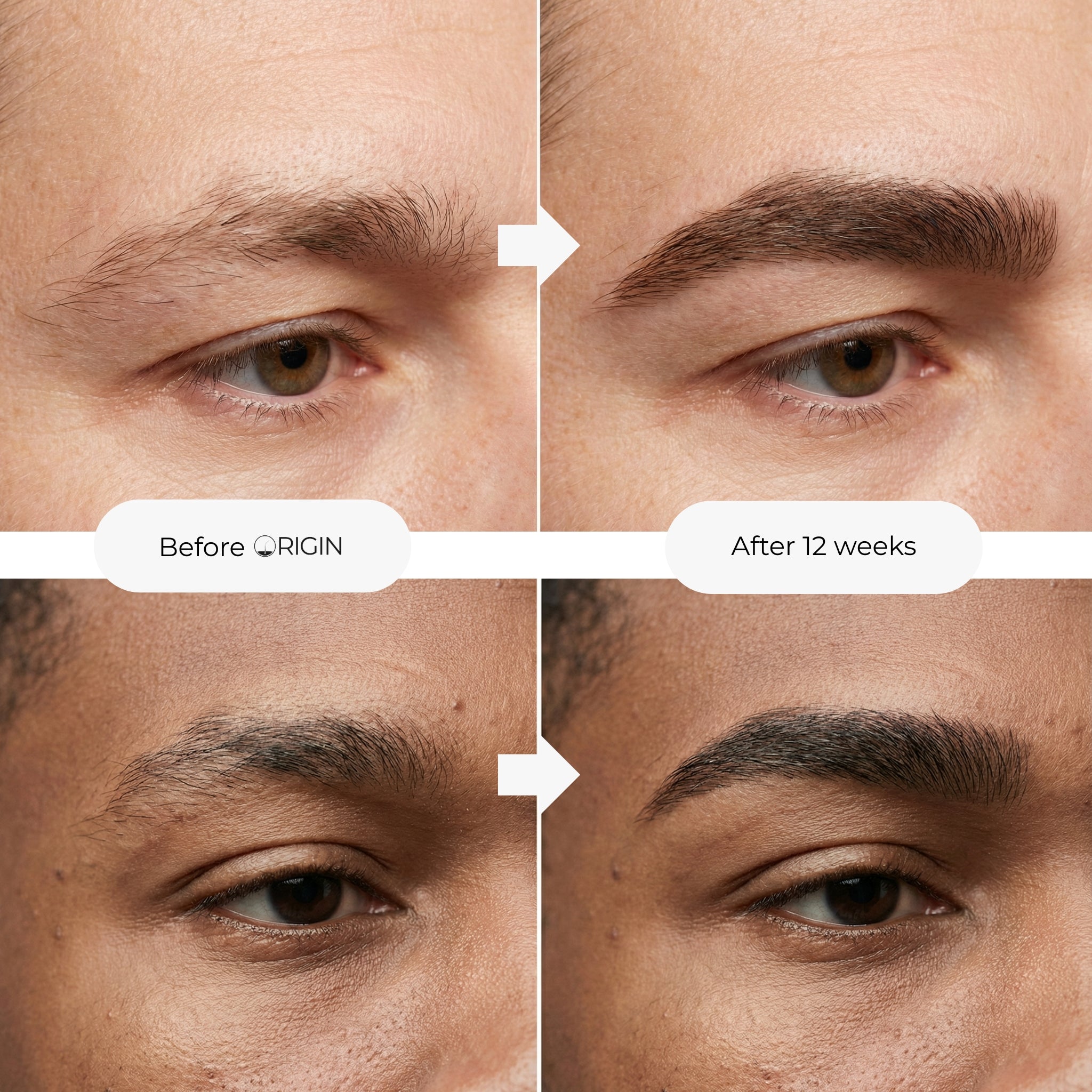 Eyebrow Growth Serum